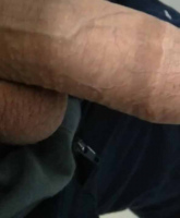 arabcircumcised-dick012